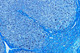 CAB Chromotrop-Anilinblau-Färbung nach Gomori