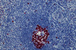 immunhisto detail Mib 1